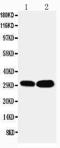 Anti-LASP1 Rabbit Antibody