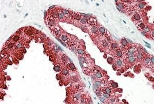 Anti-ACPP Antibody (A82939) (3.8 µg/ml) staining of paraffin embedded Human Prostate. Steamed antigen retrieval with citrate buffer pH 6, AP-staining