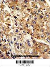 Anti-ATP1B2 Rabbit Polyclonal Antibody