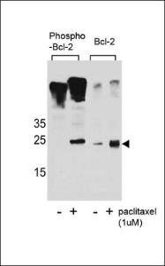 Anti-BCL2 Rabbit Polyclonal Antibody