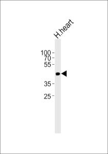 Anti-OR13C9 Rabbit Polyclonal Antibody