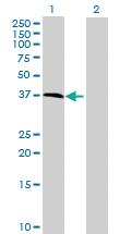 Anti-RBFA Mouse Polyclonal Antibody