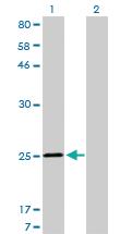 Anti-TNNI3 Mouse Monoclonal Antibody [clone: 1E7]