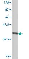 Anti-NMNAT2 Mouse Polyclonal Antibody