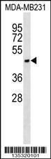 Anti-ASGR1 Rabbit Polyclonal Antibody (Biotin)