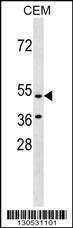 Anti-HCAR3 Rabbit Polyclonal Antibody (AP (Alkaline Phosphatase))