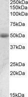 Anti-ACPP Antibody (A82940) (0.01µg/ml) staining of Human Prostate lysate (35µg protein in RIPA buffer). Primary incubation was 1 hour. Detected by chemiluminescence.