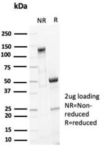 SDS-PAGE analysis of Anti-EpCAM Antibody [EGP40/7035R] under non-reduced and reduced conditions; showing intact IgG and intact heavy and light chains, respectively. SDS-PAGE analysis confirms the integrity and purity of the antibody.