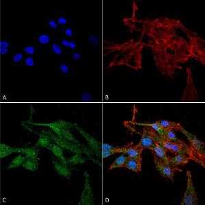 Immunocytochemistry/Immunofluorescence analysis of human colon carcinoma cell line (RKO), fixed in 4% formaldehyde for 15 min at room temperature, using Anti-RIP3 Antibody (A304917), at 1:100 for 60 minutes at room temperatur