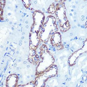 Anti-Hexokinase 1 Rabbit Monoclonal Antibody [clone: ARC0256]