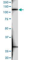 Anti-EXO1 Rabbit Polyclonal Antibody