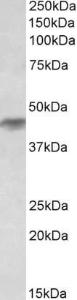 Anti-HRH2 Antibody (A82941) (0.1µg/ml) staining of Duodenum lysate (35µg protein in RIPA buffer). Primary incubation was 1 hour. Detected by chemiluminescence.