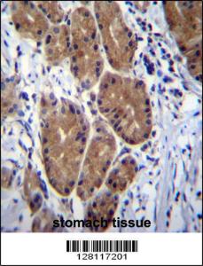 Anti-ZCRB1 Rabbit Polyclonal Antibody (PE (Phycoerythrin))