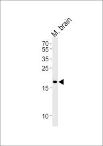 Anti-CPLX2 Rabbit Polyclonal Antibody