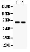 Anti-TGF beta Receptor II Rabbit Polyclonal Antibody