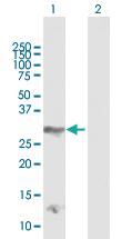 Anti-DLX4 Rabbit Polyclonal Antibody