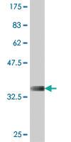 Anti-TSEN15 Mouse Polyclonal Antibody