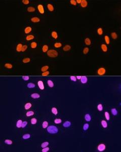 Immunofluorescence analysis of U-2 OS cells using Anti-Histone H1.2 Antibody [ARC1836] (A307750) at a dilution of 1:100 (40X lens). DAPI was used to stain the cell nuclei (blue)