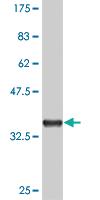 Anti-MAPKAPK3 Mouse Monoclonal Antibody [clone: 4B11]