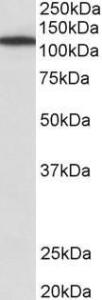 Anti-MYO1B antibody