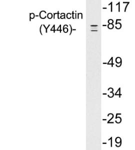 Anti-Cortactin