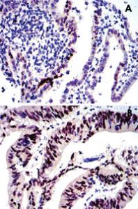 Anti-JUN Mouse Monoclonal Antibody [clone: 5B1]