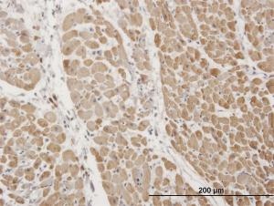 Anti-TNNI3 Mouse Monoclonal Antibody [clone: 1E7]