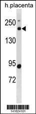 Anti-BCL9L Rabbit Polyclonal Antibody (FITC (Fluorescein Isothiocyanate))