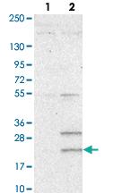 Anti-TCTEX1D1 Rabbit Polyclonal Antibody