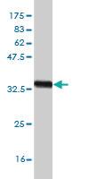 Anti-ZIC4 Mouse Monoclonal Antibody [clone: 3A2]