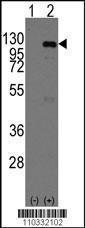 Anti-CASC3 Rabbit Polyclonal Antibody (AP (Alkaline Phosphatase))