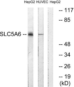 Western blot analysis of lysates from HepG2 and HUVEC cells using Anti-SLC5A6 Antibody The right hand lane represents a negative control, where the antibody is blocked by the immunising peptide