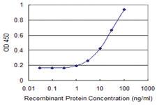 Anti-PDGFD Mouse Monoclonal Antibody [clone: 4H2]