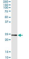 Anti-UBE2T Antibody Pair