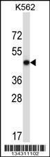 Anti-METAP2 Rabbit Polyclonal Antibody (AP (Alkaline Phosphatase))