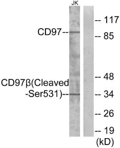 Western blot analysis of lysates from Jurkat cells, treated with etoposide 25uM 24h using Anti-CD97 beta (cleaved Ser531) Antibody. The right hand lane represents a negative control, where the antibody is blocked by the immunising peptide