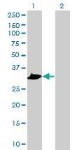 Anti-PRPS1 Mouse Polyclonal Antibody