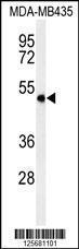 Anti-SMPDL3A Rabbit Polyclonal Antibody (AP (Alkaline Phosphatase))