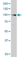 Anti-EXO1 Mouse Monoclonal Antibody [clone: 1G12]