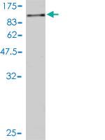 Anti-ADD1 Mouse Monoclonal Antibody [clone: 2C9]