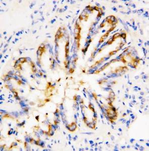 Anti-Calpain 1 Rabbit Polyclonal Antibody