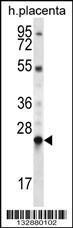 Anti-LHFPL1 Rabbit Polyclonal Antibody (Biotin)