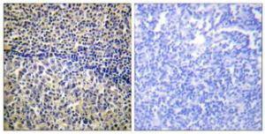 Anti-NCF1 Rabbit Polyclonal Antibody