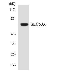 Western blot analysis of the lysates from COLO205 cells using Anti-SLC5A6 Antibody