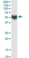 Anti-SNX17 Mouse Monoclonal Antibody [clone: 2A3]