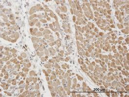 Anti-TNNI3 Mouse Monoclonal Antibody [clone: 1E7]