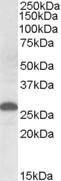 Anti-Apom Antibody (A84557) (0.5µg/ml) staining of Human Placenta lysate (35µg protein in RIPA buffer). Primary incubation was 1 hour. Detected by chemiluminescence.