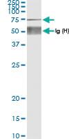 Anti-XRCC6 Rabbit Polyclonal Antibody