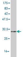 Anti-UCP1 Mouse Monoclonal Antibody [clone: 4E5]