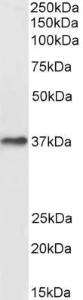 Anti-ACKR1 Antibody (A82945) (0.3µg/ml) staining of Human Liver lysate (35µg protein in RIPA buffer). Primary incubation was 1 hour. Detected by chemiluminescence.